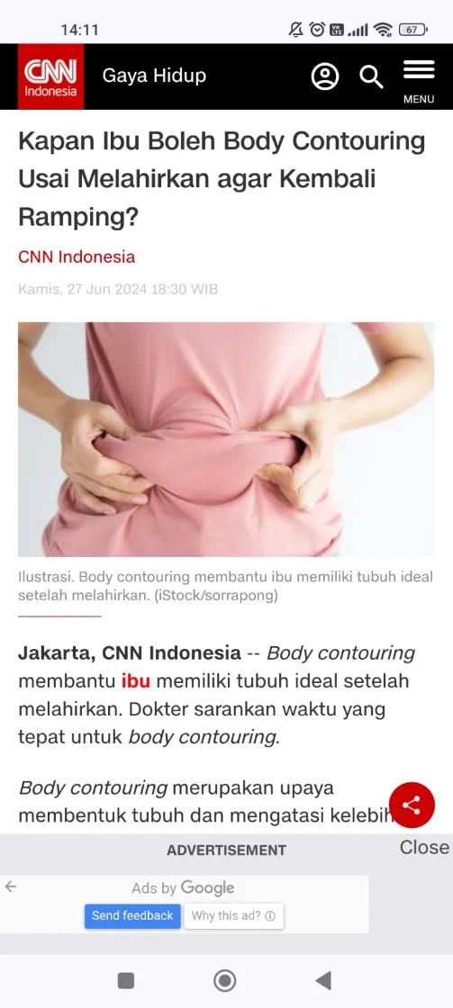 Liputan Media - Klinik Bedah Plastik - Klinik Utama DR Indrajana