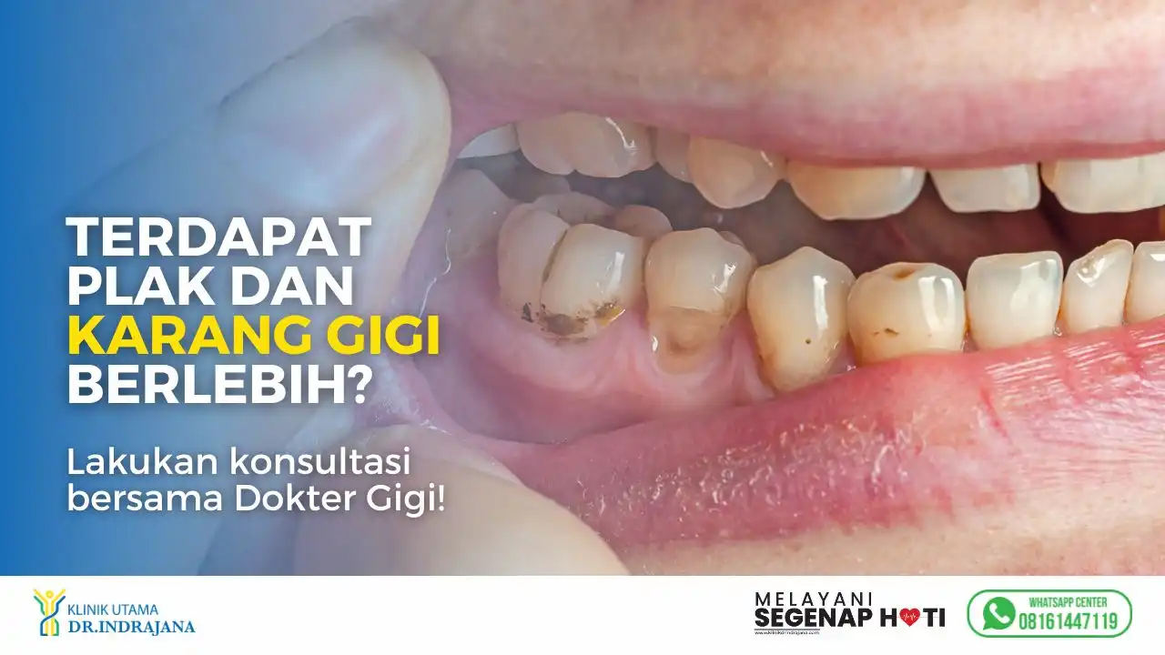 Permasalahan-pada-Gigi-Dokter-Gigi-Klinik-Gigi-Klinik-Utama-DR-Indrajana-4.webp