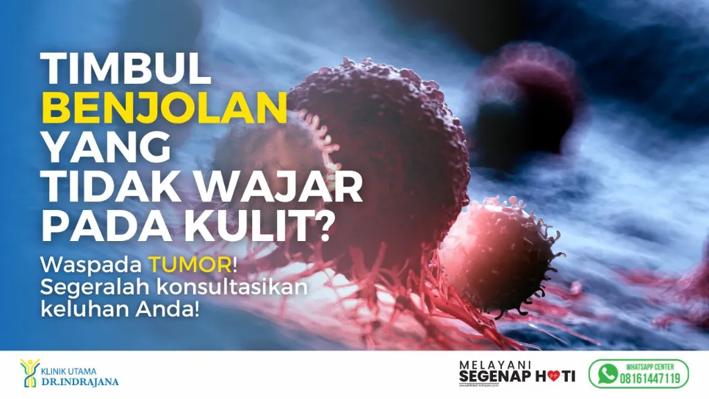 Banner-Keluhan-Klinik-Spesialis-Bedah-Umum-1