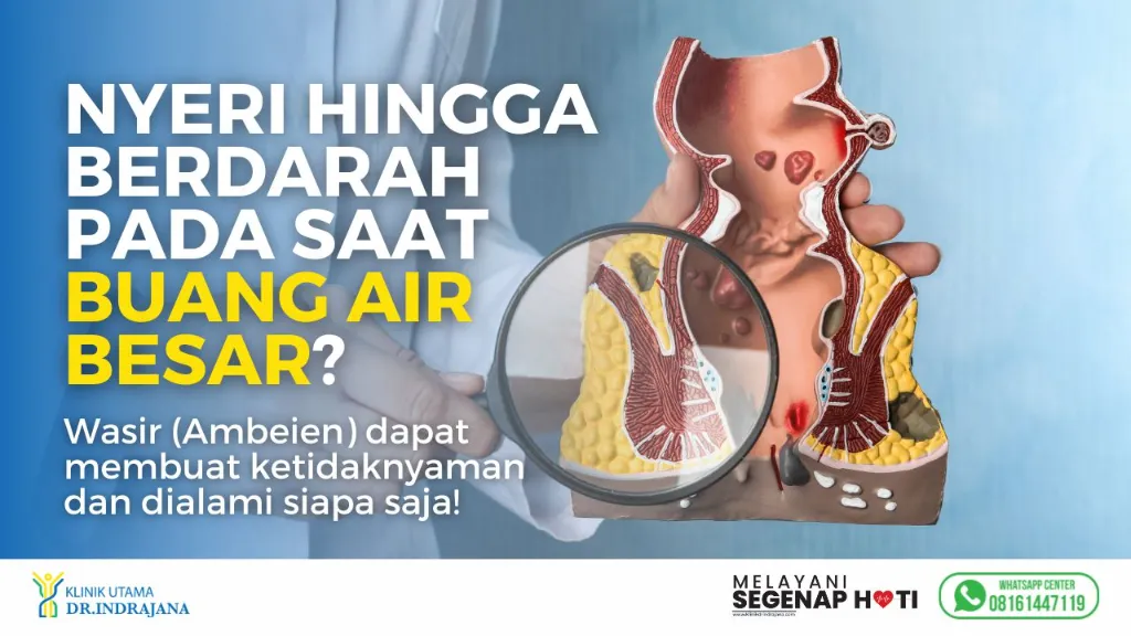 Banner-Keluhan-Klinik-Spesialis-Bedah-Umum-2