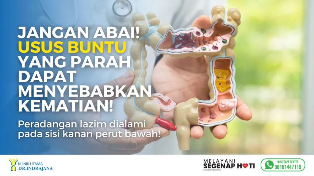 Banner-Keluhan-Klinik-Spesialis-Bedah-Umum-4